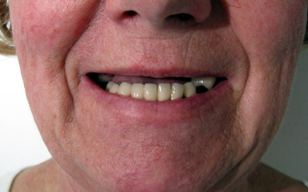 ferencne-sourire-avant